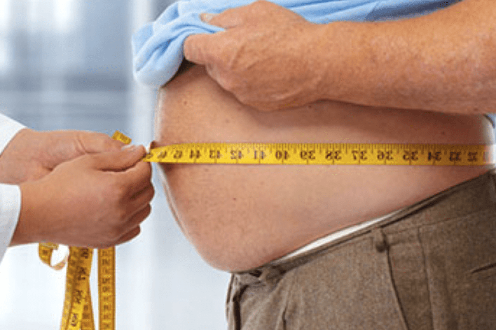 Obesity