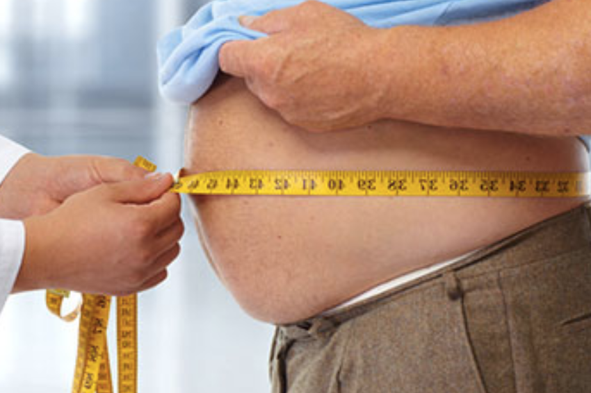 OBESITY